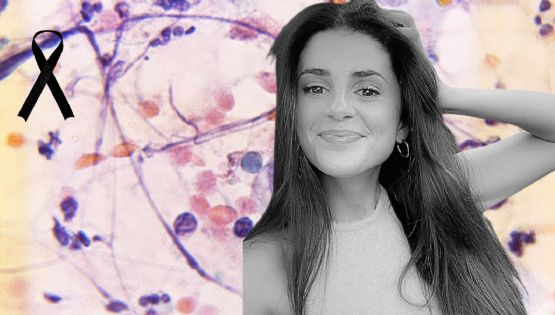 Rachel Yaffe: Esta fue su última publicación antes de morir; ¿qué raro cáncer padeció?
